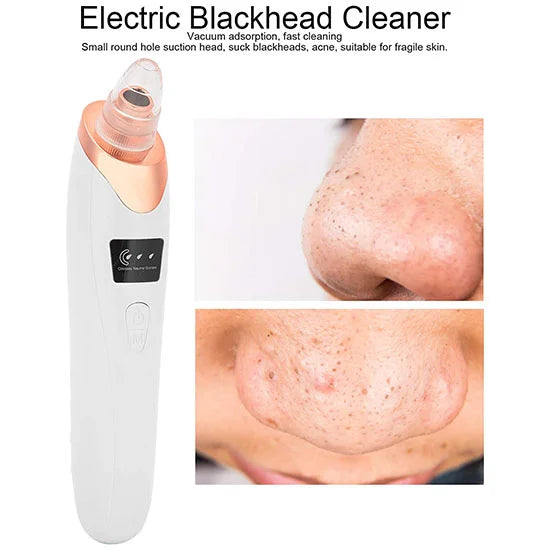 Electric Blackhead Remover vacuum pore cleaner with 5 suction heads