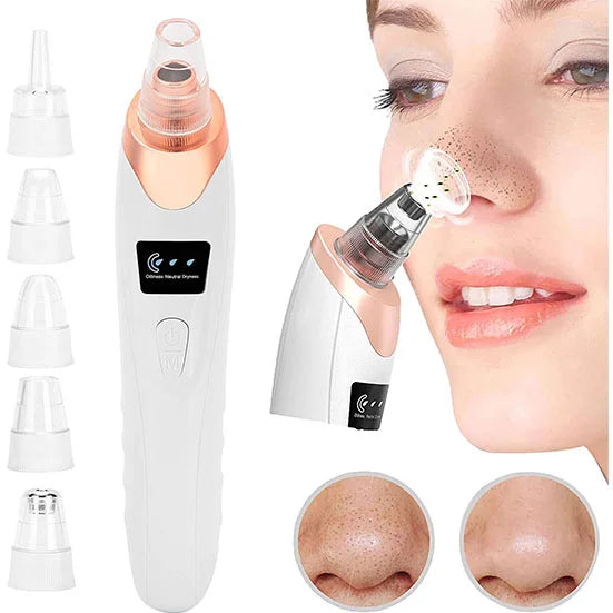 Electric Blackhead Remover being used on nose to remove blackheads