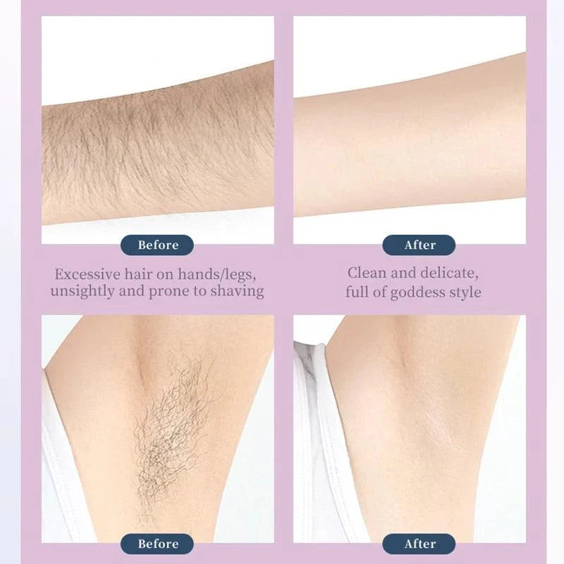 Kemei epilator before and after results on arms and underarms